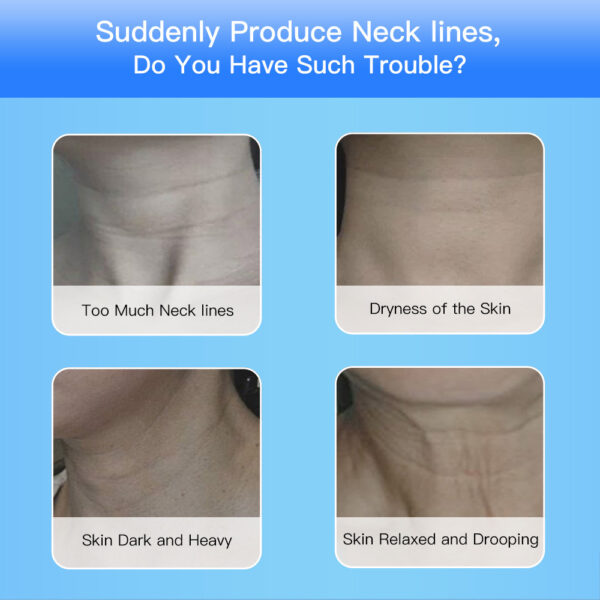 EMS Microcurrent Face & Neck Lifting Device - Image 10